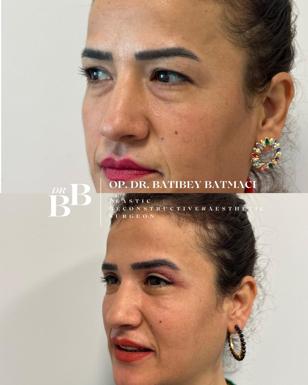$ {
operationInfo?.title || subMenu.title
} - Veneta Clinic Uzman Doktorları